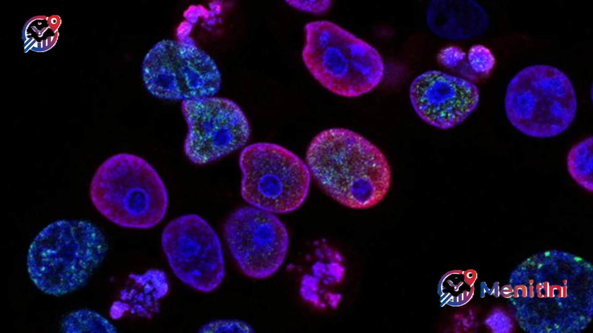 Terobosan Kedokteran Nuklir: Mengupas Peran Vital PET-CT dan SPECT-CT dalam Deteksi Dini Kanker yang Lebih Akurat