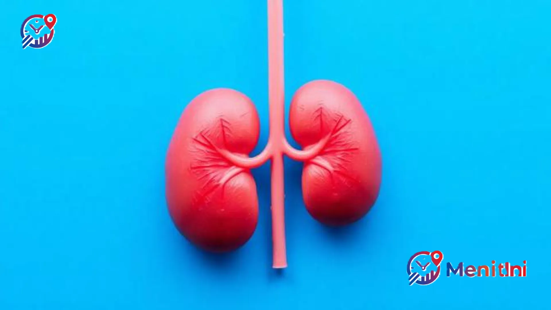 Mengenal Hidronefrosis: Bahaya Tersembunyi Saat Ginjal ‘Kebanjiran’ Urine dan Cara Menanganinya