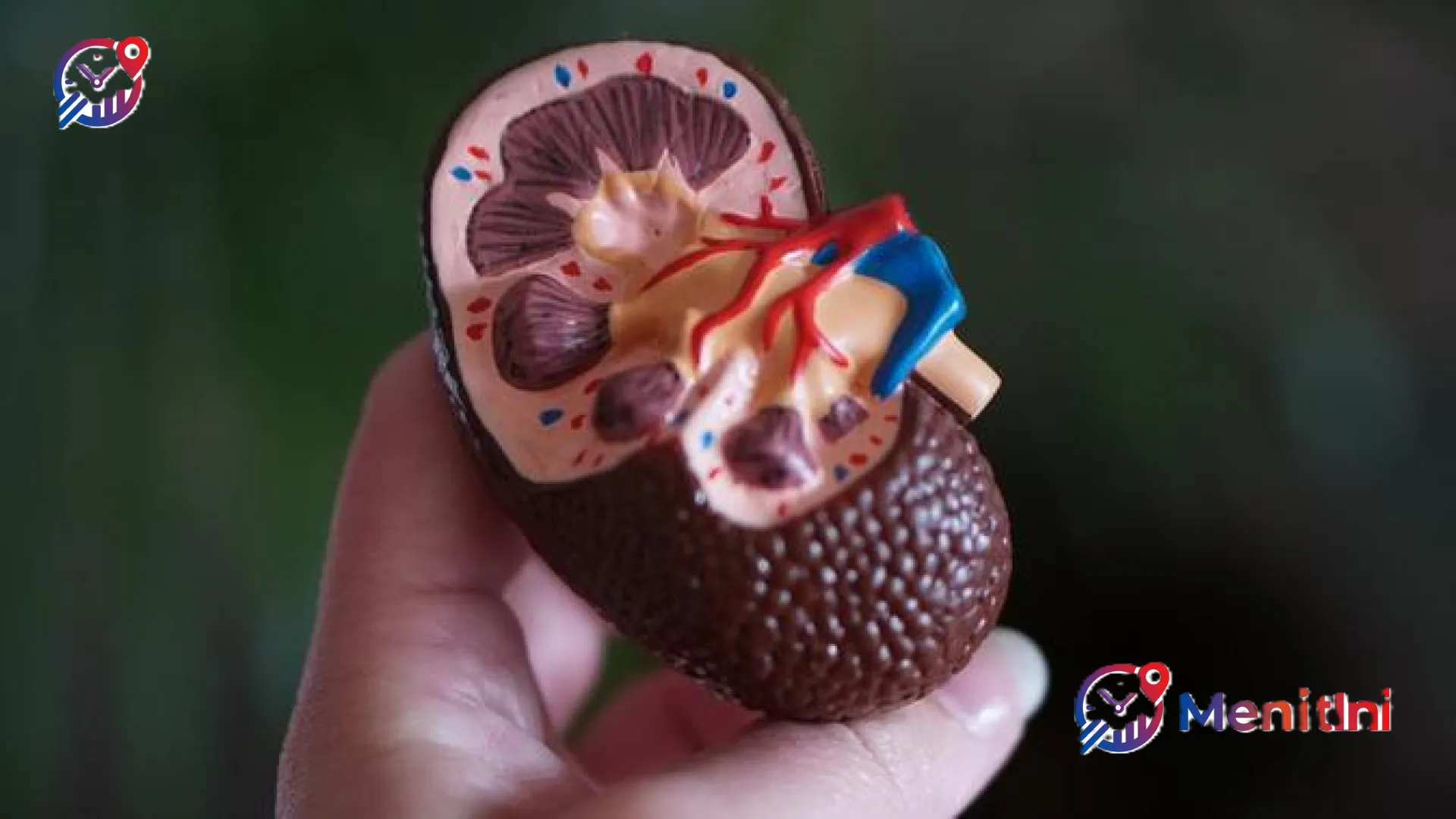 Waspada Gejala Tersembunyi Kanker Ginjal, Kenali Teknologi Deteksi Dini untuk Harapan Sembuh Lebih Tinggi